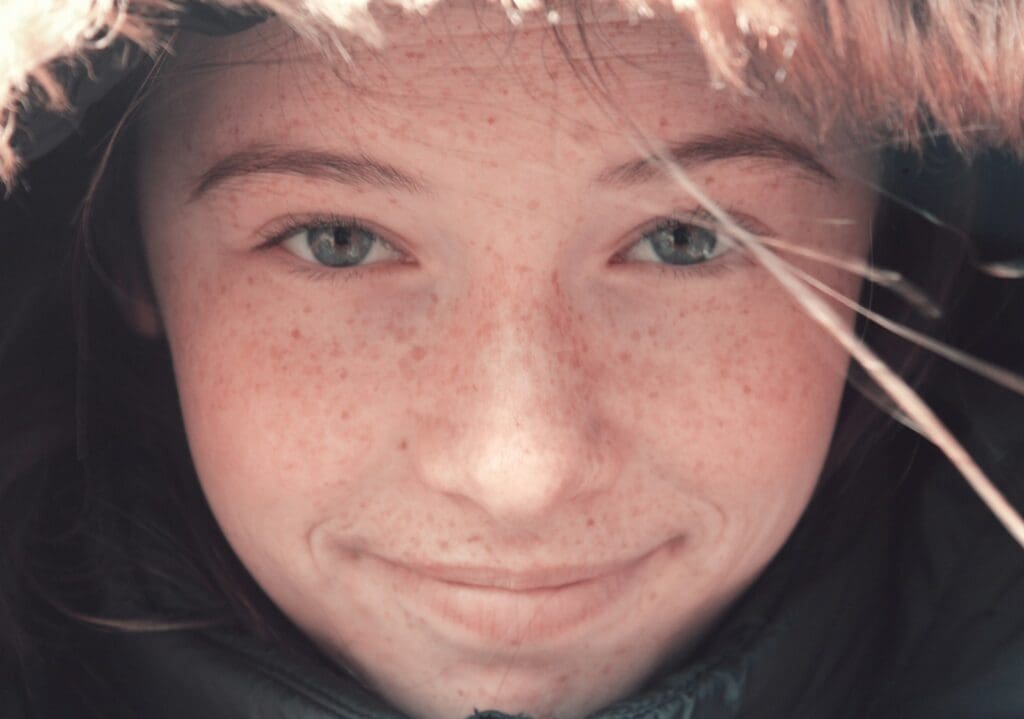 a woman with freckled hair and blue eyes wearing a hooded jacket